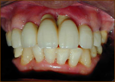 50Α@9@AFTER